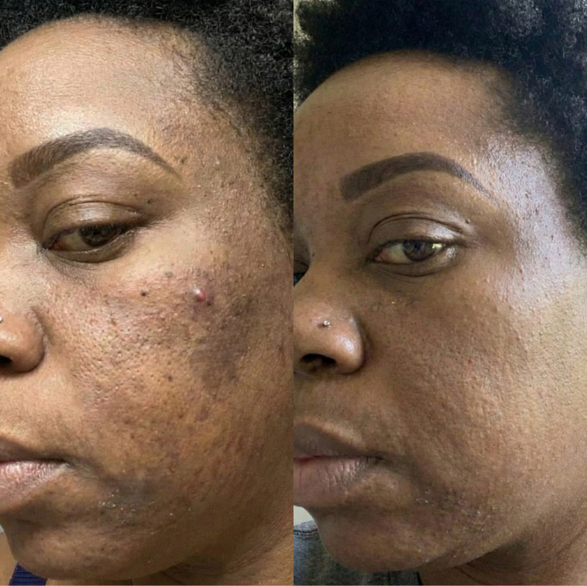 Routine Anti-Imperfections