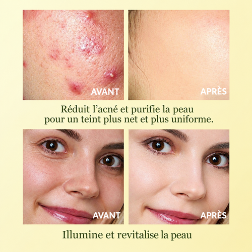 Pads Nettoyant
