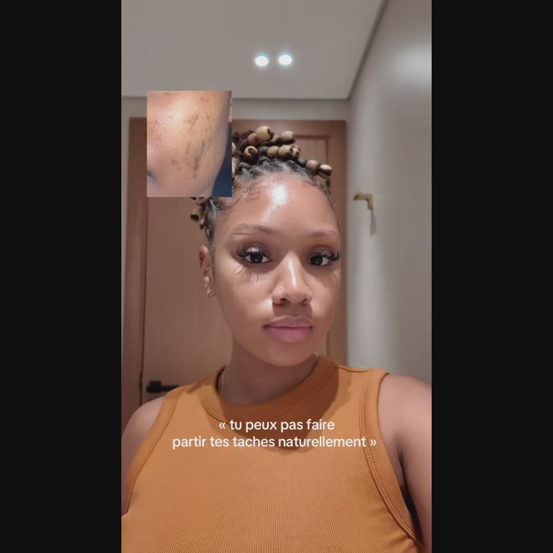 Routine Anti-Imperfections